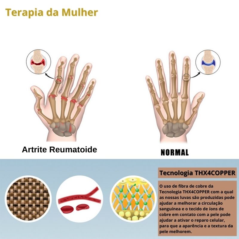 Luvas Terapêuticas de Compressão Anti-Artrite